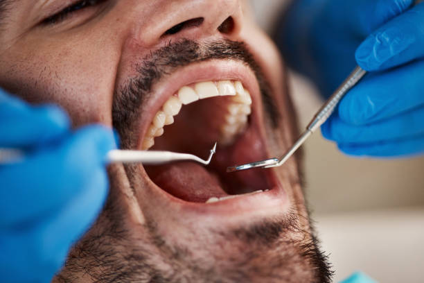 Best Urgent Dental Care  in Lesslie, SC